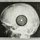 Illustration for article titled Soviet-era bootleg recordings made on discarded X-ray plates